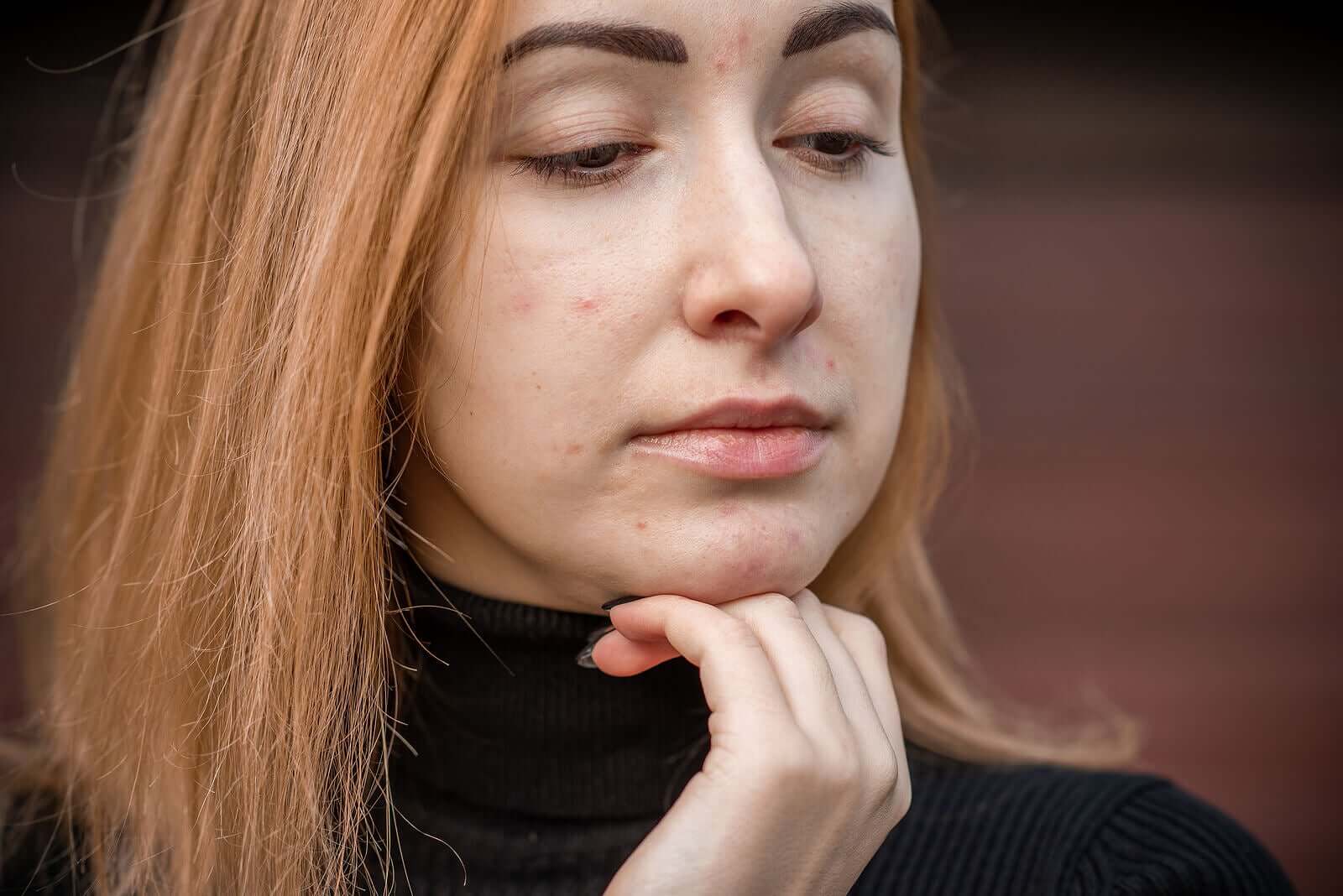 Teenage Acne: Types and Causes