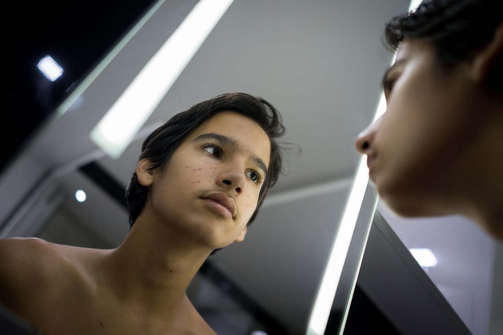 Body Dysmorphic Disorder in Teenagers