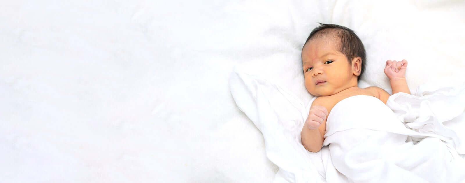 What Is Kabuki Syndrome?