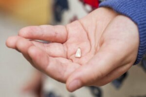 Dental Avulsion in Children: What It Is and How to Act