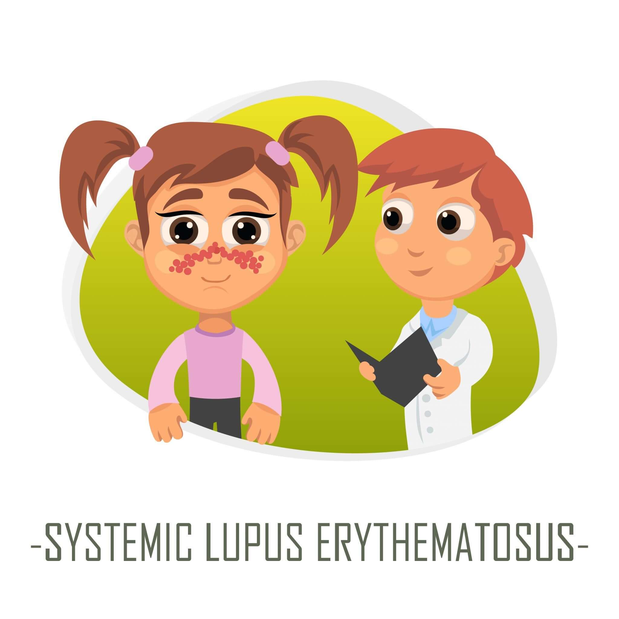 Lupus hos barn.