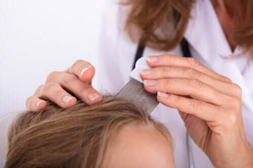 Pediculosis in Children: What You Need to Know About Lice