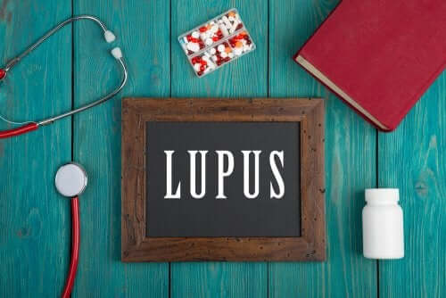 Systemic Lupus Erythematosus in Children