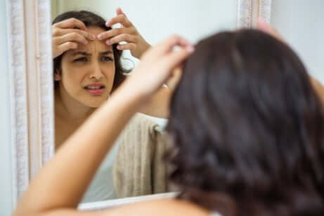 Food and Acne: What You Eat Matters