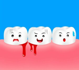 Gingivitis in Children: Symptoms and Treatment