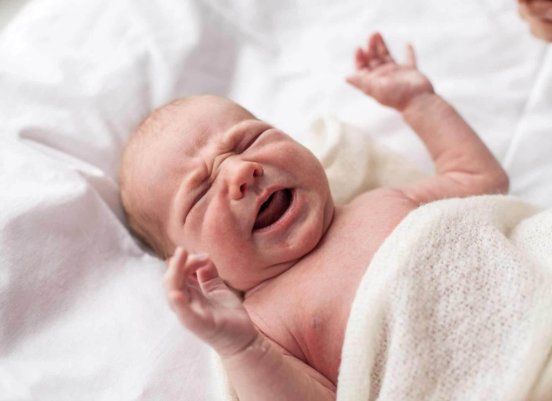 Baby with pimples on the face.