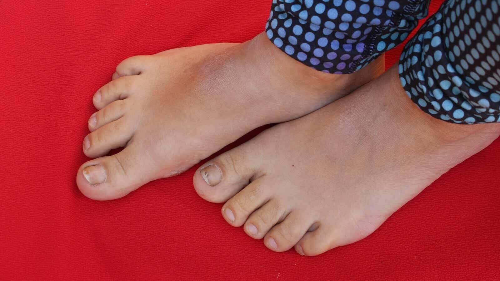 10 Tips to Prevent Foot Odor in Children