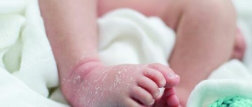 10 Most Common Skin Conditions in Babies