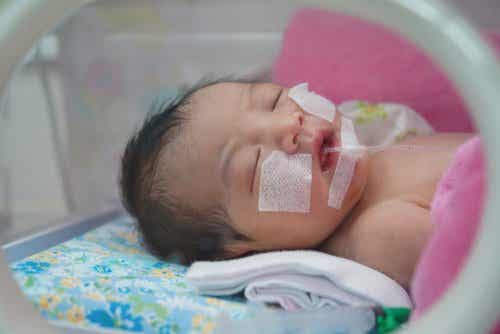 A premature baby with a feeding tube.