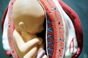 The Gestational Sac: Basic Aspects