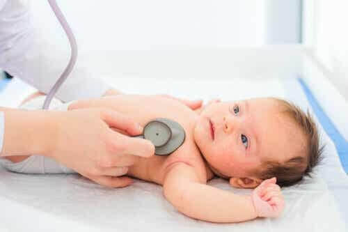 Herzgeräusche - Kinderarzt hört das Herz eines Babys ab.