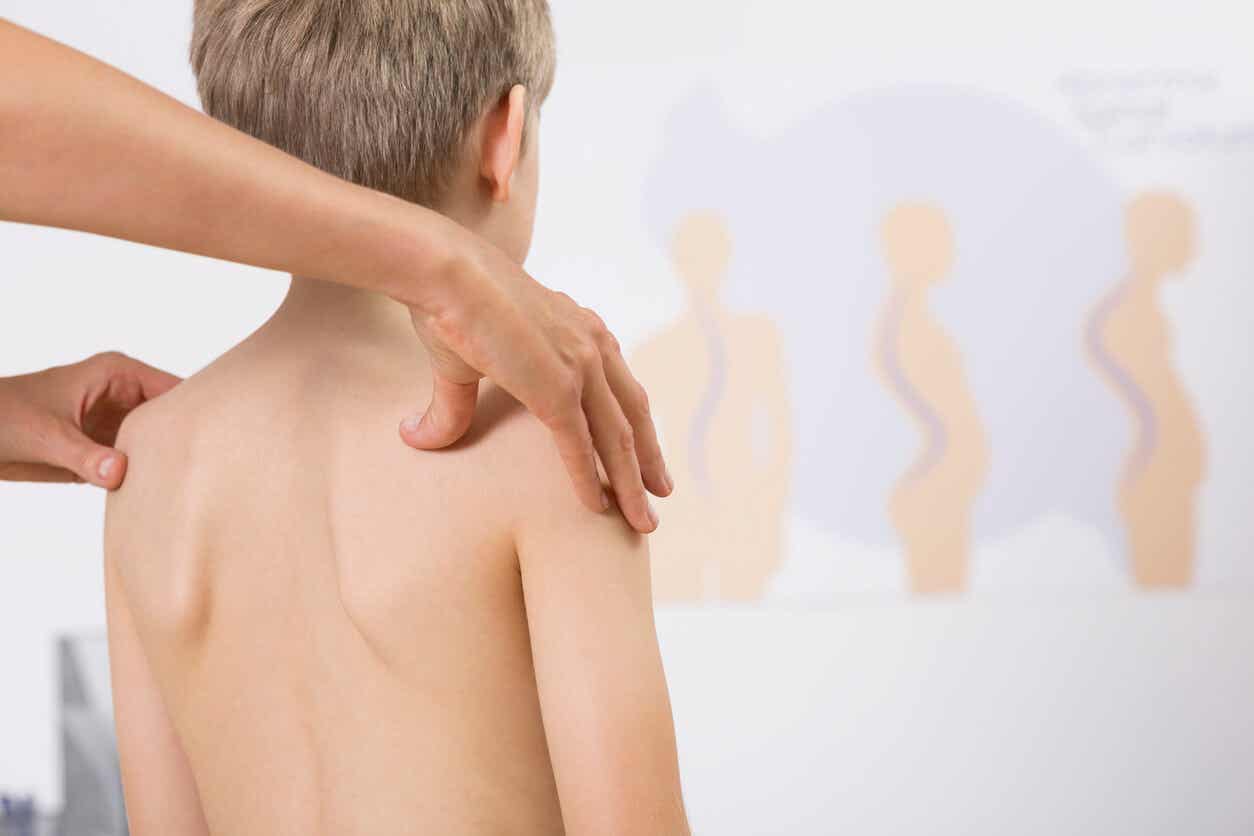 Scoliose behandeling.