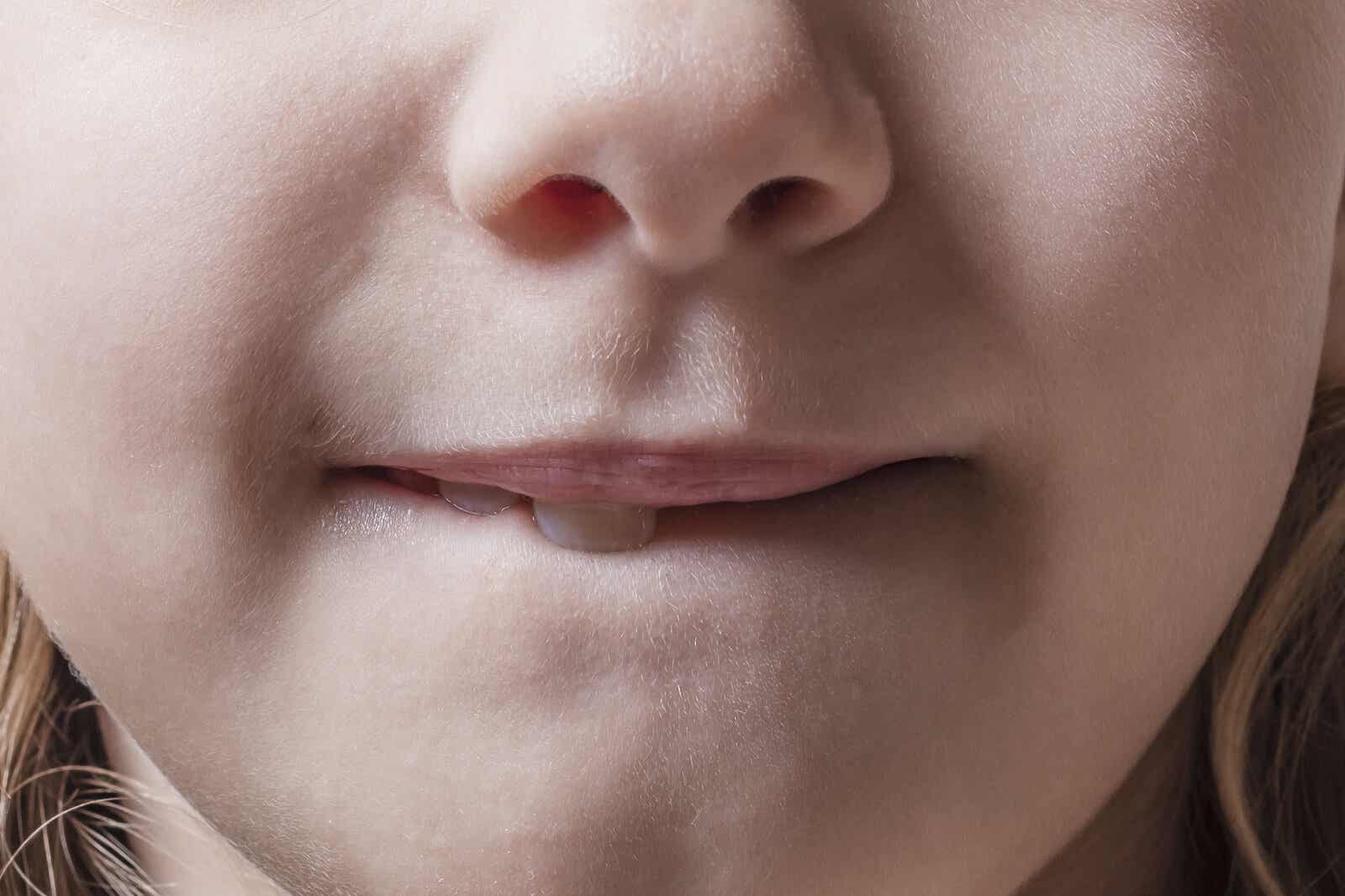 Bijtproblemen bij kinderen