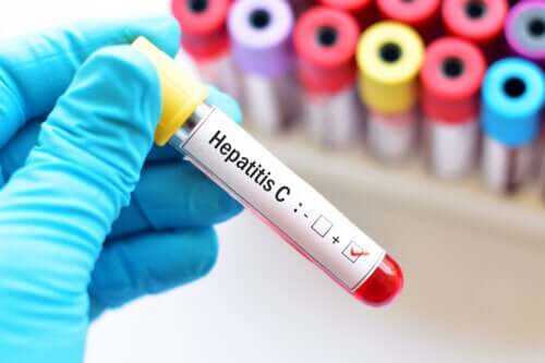 Hepatitis C During Pregnancy