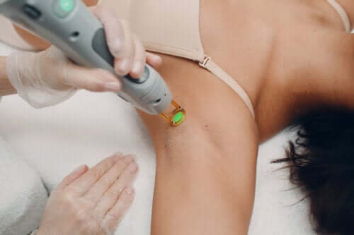 Laser Hair Removal for Teenagers: What You Need to Know