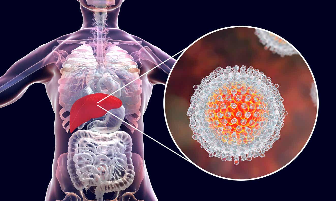 Hepatitis C tijdens de zwangerschap