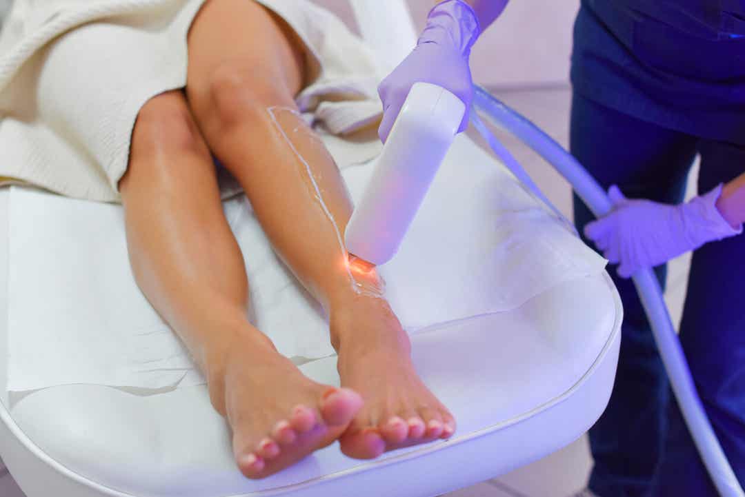 A woman undergoing laser hair removal on her legs.