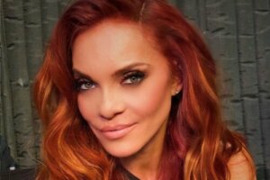 2 Celebrities With Cleft Lip