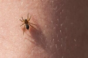 All About Flea and Spider Bites in Children