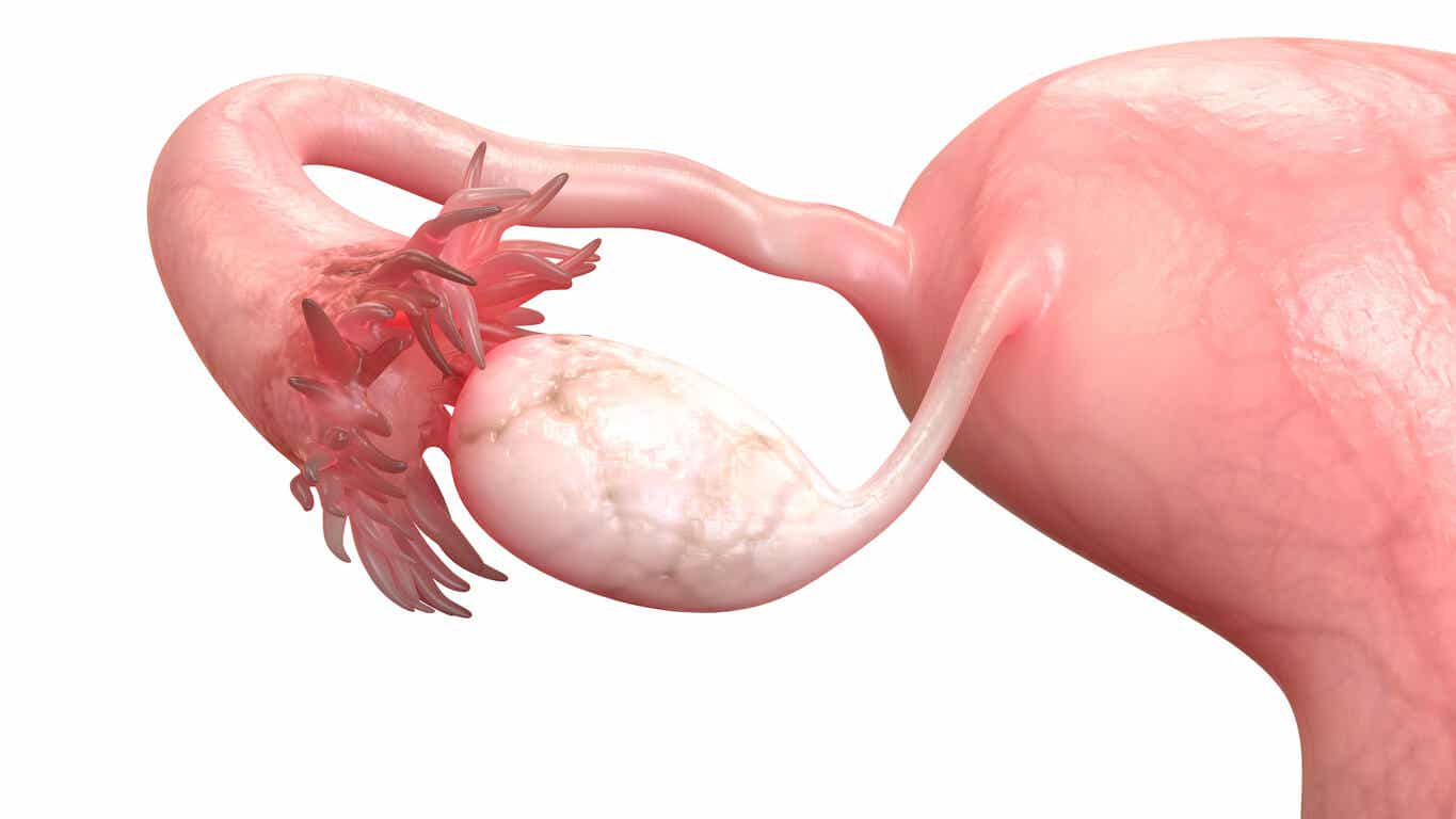 An image of an ovary.