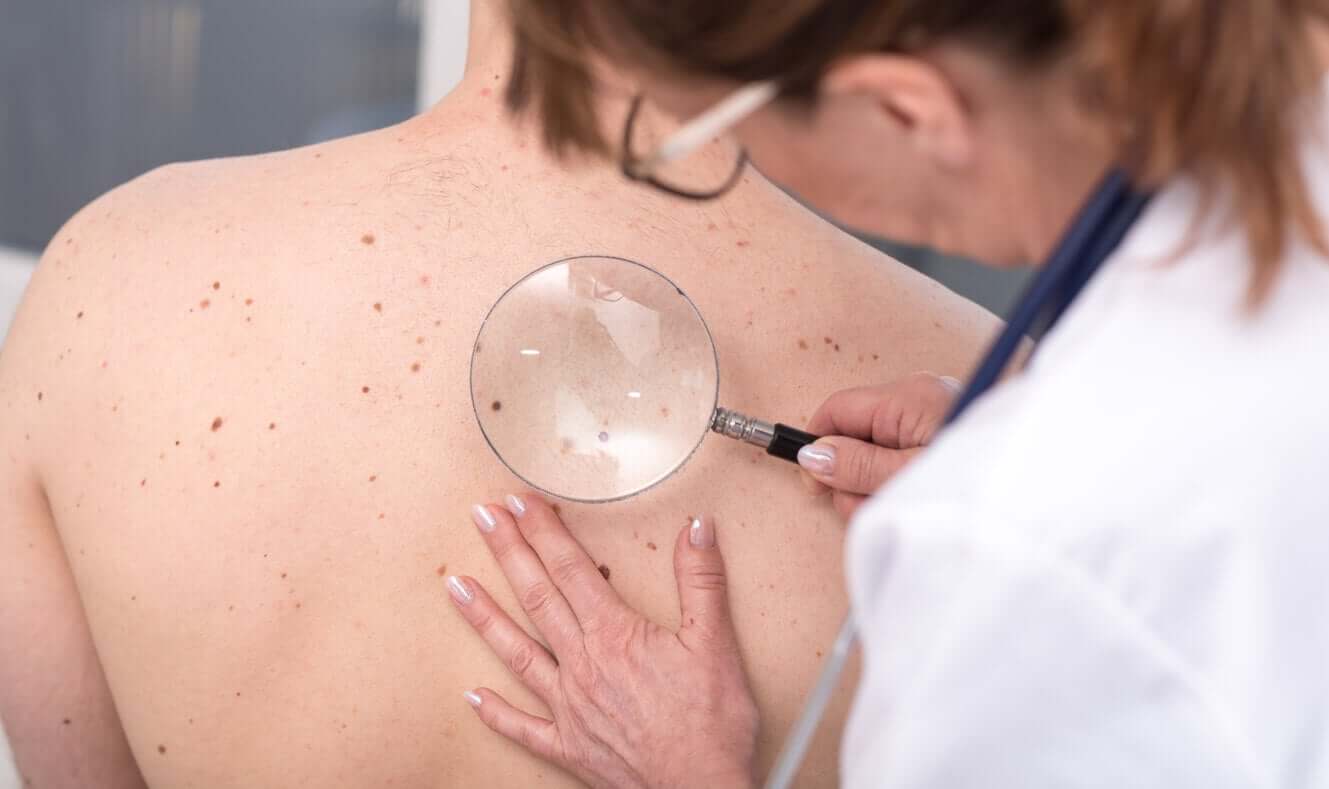 A dermatologist looking a moles on a young man's back.