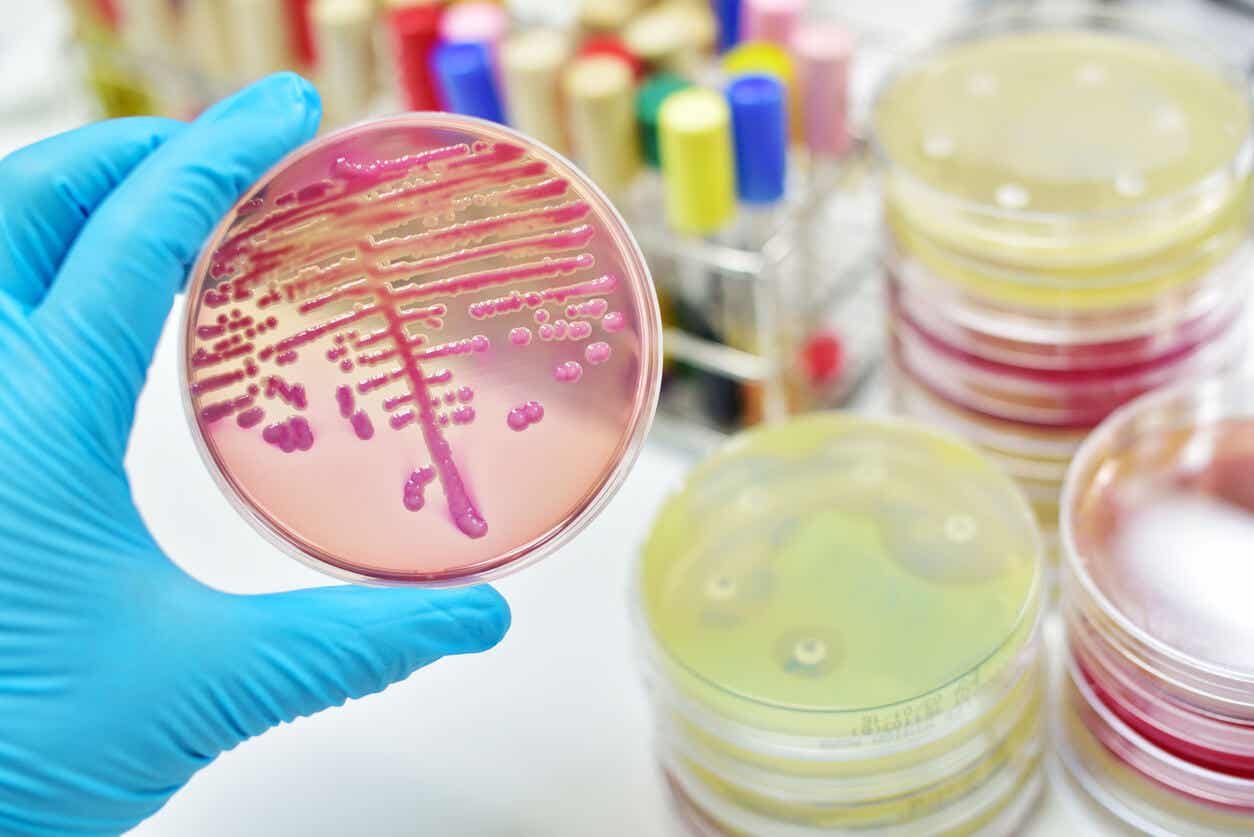 Bacteria cultures in a lab.