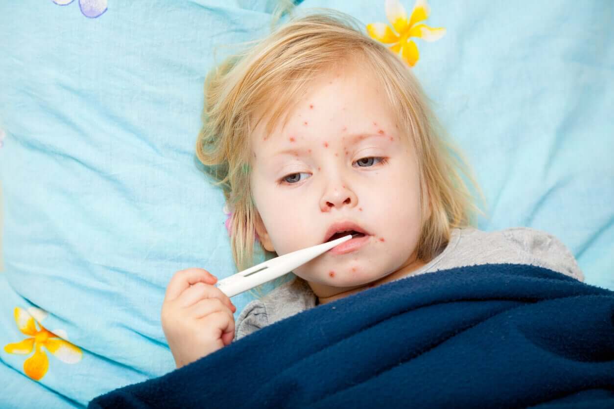 A toddler with measles with a thermometer in her mouth.