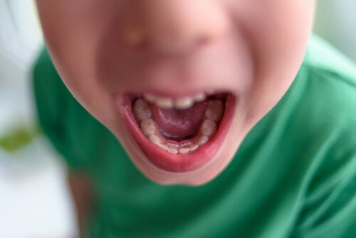 Double Row of Teeth in Children: What To Do?