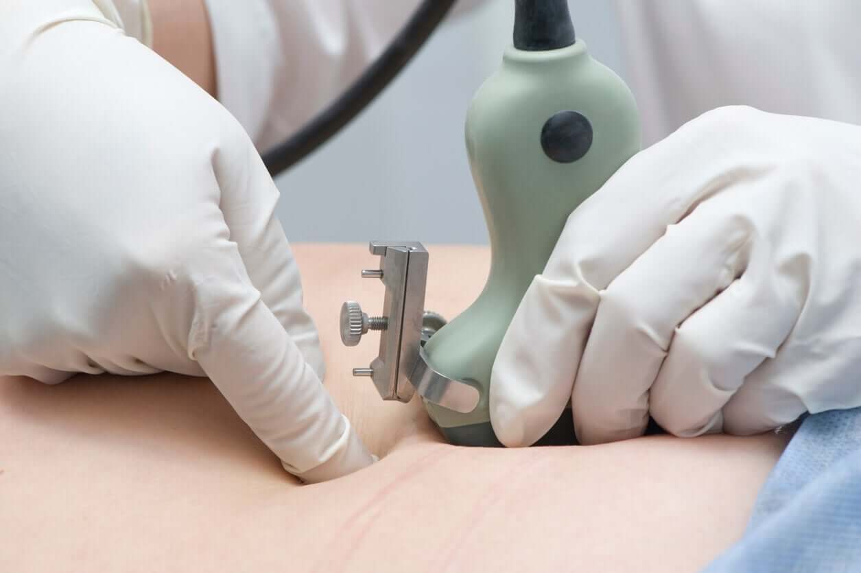 A doctor performing prenatal screening.