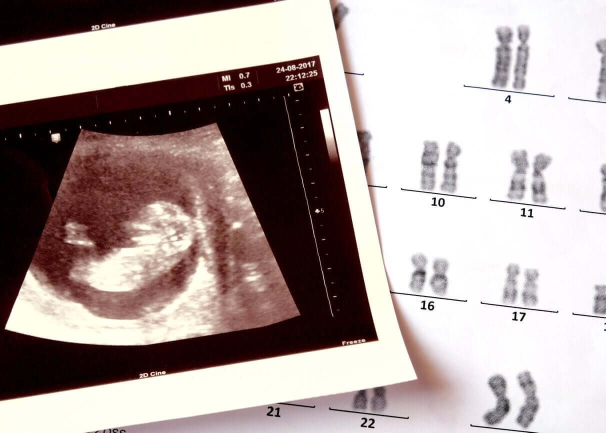 An ultrasound image and genetic testing.