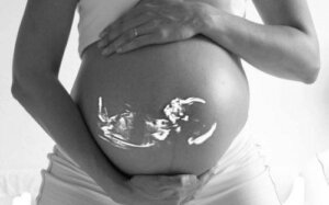 Pregnancy After a Tubal Ligation, Is it Possible?