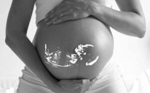 Pregnancy After a Tubal Ligation, Is it Possible?