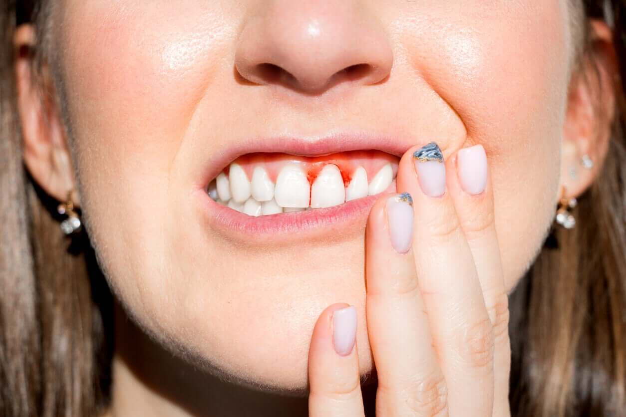 A woman with bleeding gums.