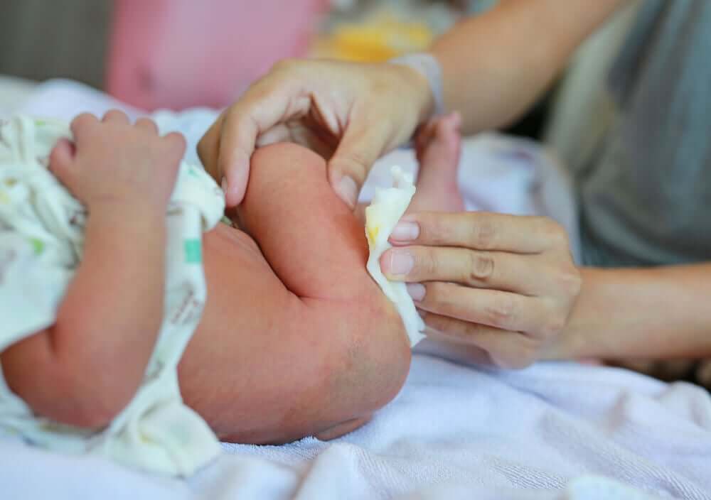 Blutiger Stuhlgang bei Babys - Mutter wechselt die Windel ihres Babys