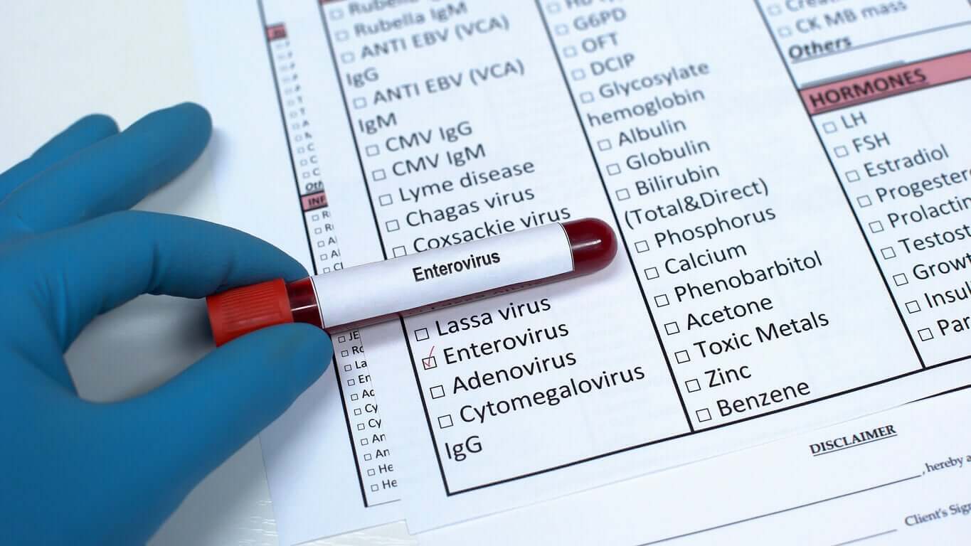 Et hetteglass med blod merket "enterovirus".