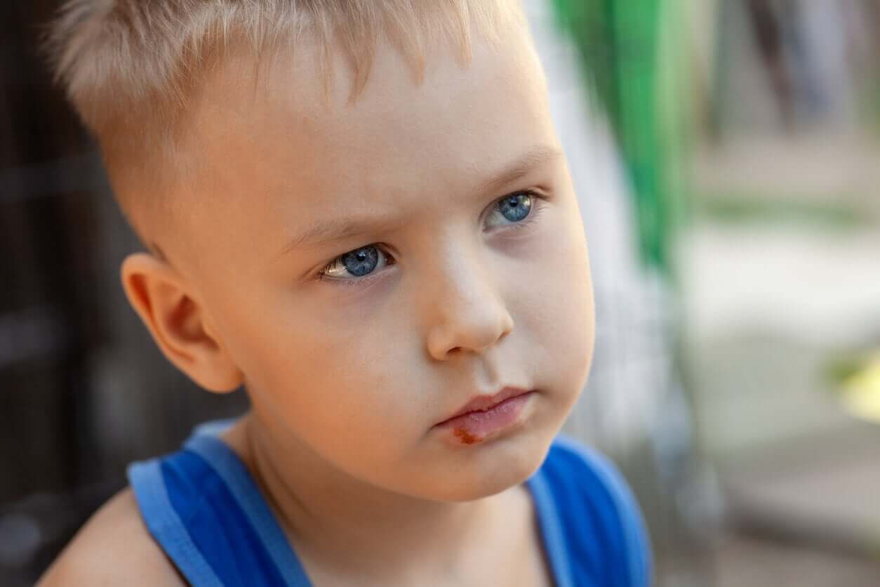 A toddler boy with herpes on his bottom lip.