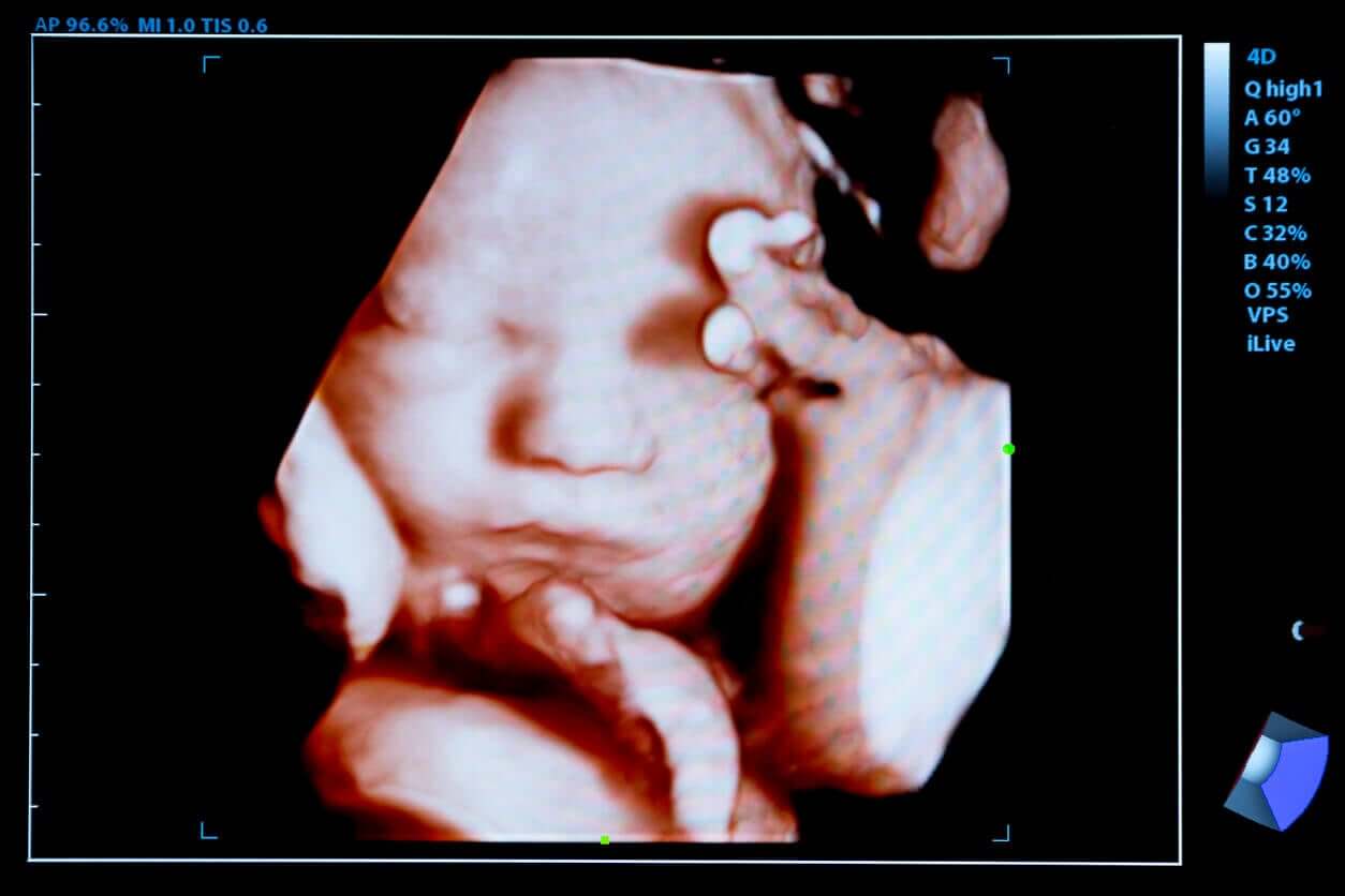 A 4D image of a baby on a screen.