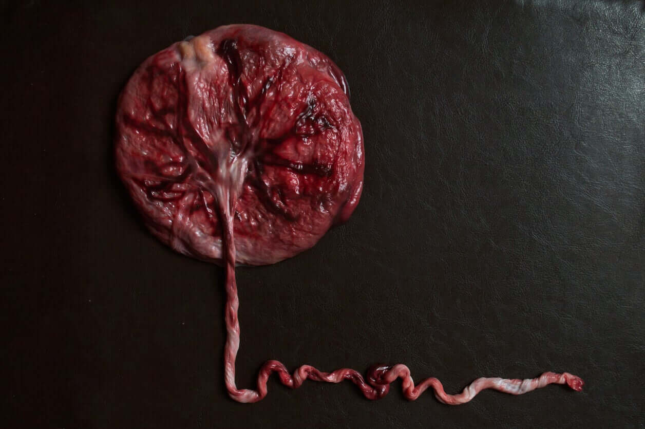 An intact placenta.