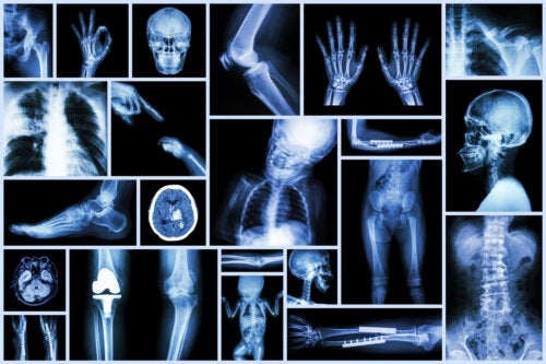 X-rays in Children: What You Need to Know