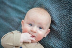 10 Natural Remedies for Atopic Skin in Babies