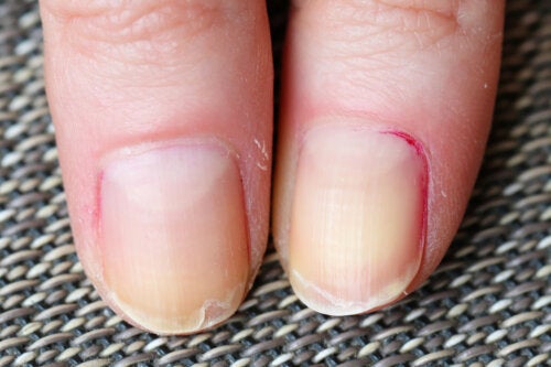 Home Remedies to Strengthen Your Nails Postpartum