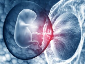 Calcified Placenta: What You Need to Know