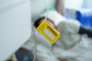 Types of Anesthesia in Labor