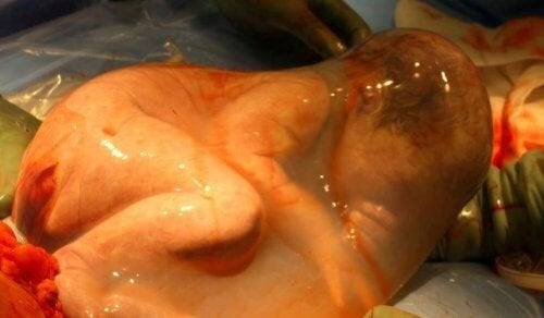 The Magic of Veiled Births