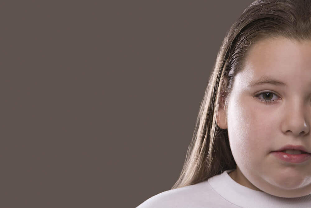 Overvægtig pige kan opleve halsbrand hos børn