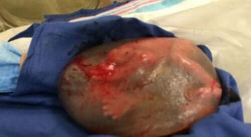 Baby født i sejrskåbe