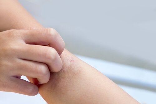 White Spots on Children's Skin