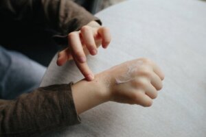 Chilblains in Children: What to Do?