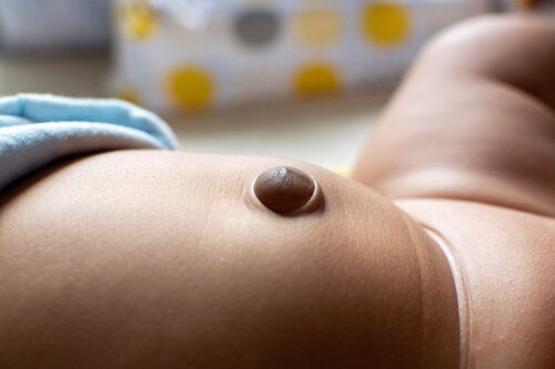 Abnormalities in a Newborn's Belly Button