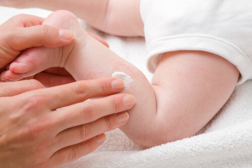 10 Natural Remedies for Dry Skin in Babies